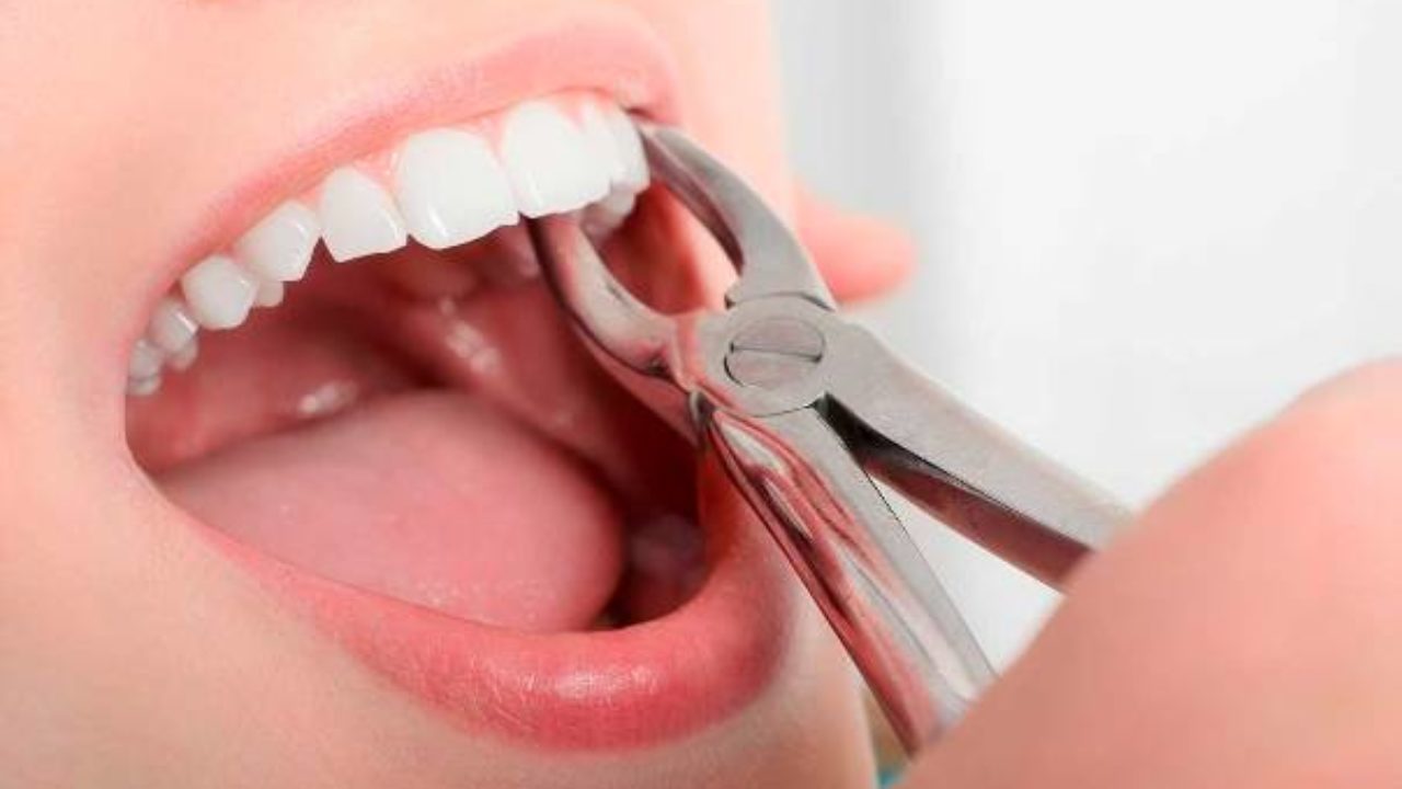 Mơ Thấy Răng Lung Lay Là Điềm Tốt Hay Điềm Xấu? Đánh Số Gì Khi Mơ Thấy Răng Lung Lay?